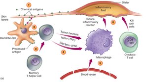 Mechanism of delayed-type hypersensitivity