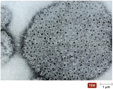 Membrane attack complexes
