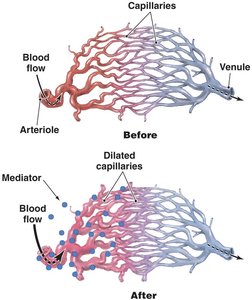 Dilating effect of inflammatory mediators