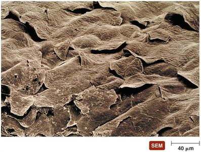 Scanning electron micrograph of skin