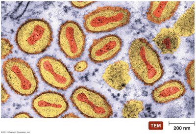 Transmission electron micrograph of poxvirus particles