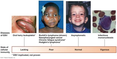Diseases associated with Epstein-Barr virus