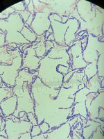 Gram-stained bacteria under oil immersion, showing purple Gram-positive bacilli