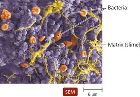 SEM image of biofilm matrix