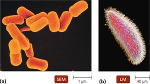 SEM and LM images of prokaryotic and eukaryotic cells