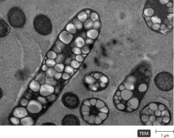 Granules of PHB in a bacterium