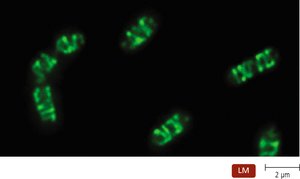 Helical cytoskeleton