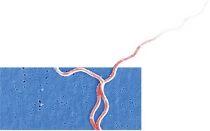 Borrelia burgdorferi spirochete