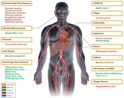 Overview of infectious diseases affecting the cardiovascular and lymphatic systems