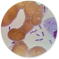 Yersinia pestis under microscope