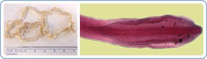 Fish tapeworm adult