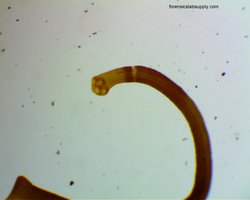 Hymenolepis eggs