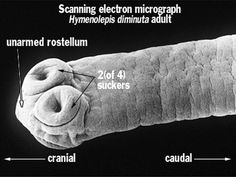 Hymenolepis adult