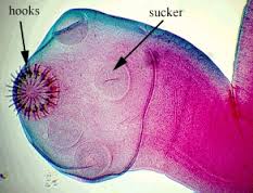 Taenia solium scolex