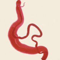 Schistosoma adult