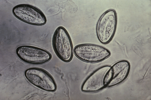 Whipworm eggs under microscope