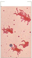 Flagella stain