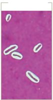 Capsule stain