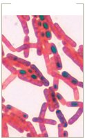 Endospore stain