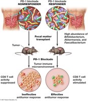 Gut microbiome and immunotherapy efficacy