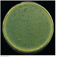 Viral plaques in bacterial lawn