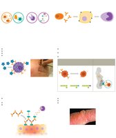 Immune system disorders summary