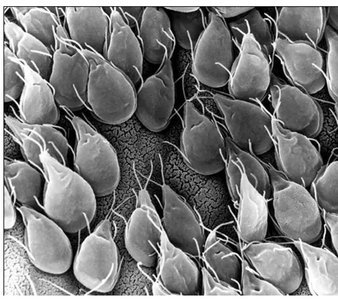 Scanning electron micrograph of protozoa
