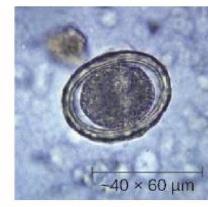 Ascaris eggs under microscope