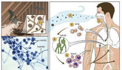 Histoplasmosis infection pathway