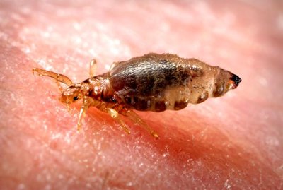 Human body louse, vector of epidemic typhus