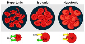 Effects of hypotonic and hypertonic solutions on cells