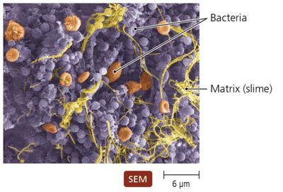 Biofilm matrix with bacteria and slime