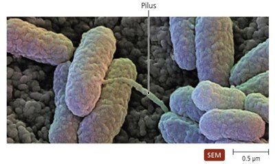 SEM of a pilus connecting bacterial cells