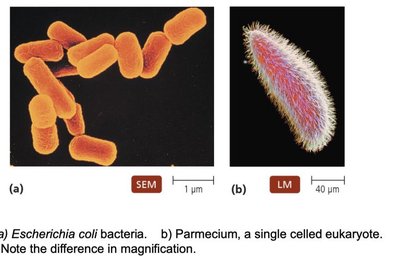 SEM of Escherichia coli and LM of Paramecium