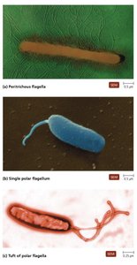 Micrographs of basic arrangements of bacterial flagella