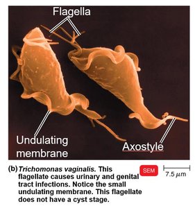 SEM image of Trichomonas vaginalis with flagella and axostyle