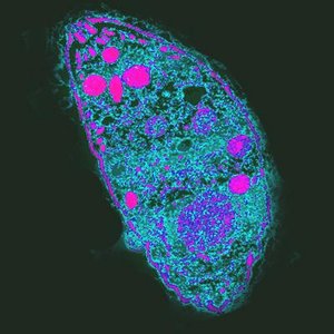 Microscopy image of Toxoplasma gondii