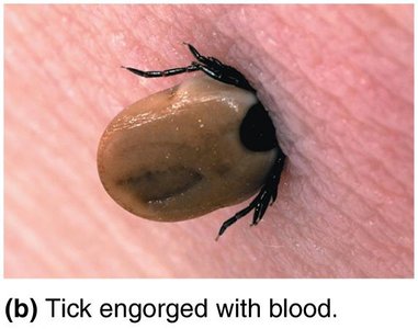 Tick engorged with blood, example of arthropod vector