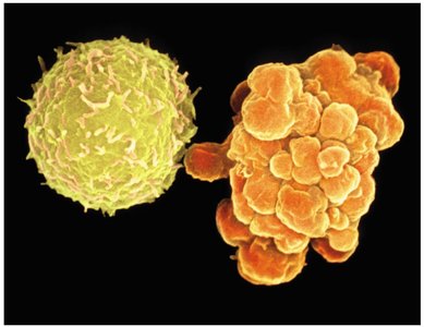 Apoptosis