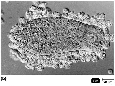 Eosinophils adhering to a parasitic fluke