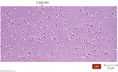Klebsiella capsules under microscope