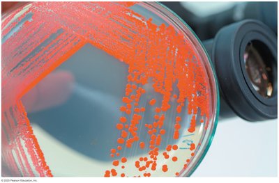 Serratia marcescens red pigment on agar