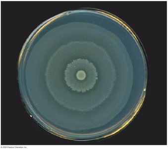 Proteus mirabilis swarming on agar