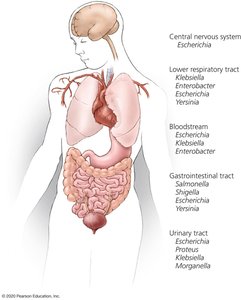 Sites of infection by Enterobacteriaceae