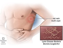 Fecal-oral route diagram