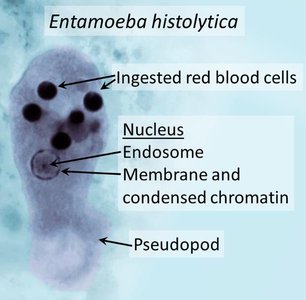 Entamoeba histolytica labeled diagram
