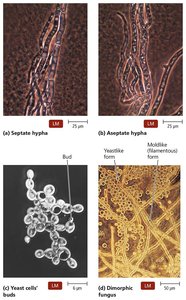 Fungal morphology: septate hypha, aseptate hypha, yeast cells, dimorphic fungus