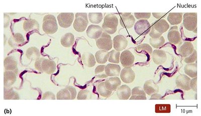 Trypanosoma in a blood smear, showing kinetoplast and nucleus