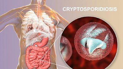 Cryptosporidiosis illustration