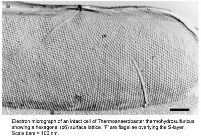 Electron micrograph of archaeal S-layer